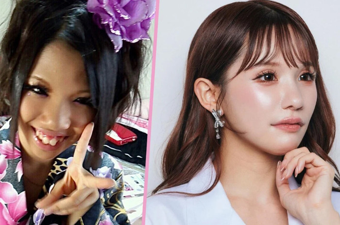 Ngoại hình của người mẫu Airi Hirase trước và sau khi trải qua 20 lần phẫu thuật thẩm mỹ.
