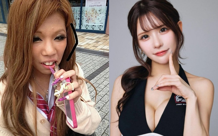 Bị mẹ ruột miệt thị, nữ người mẫu 'lột xác' sau 27 lần phẫu thuật thẩm mỹ Ảnh 2