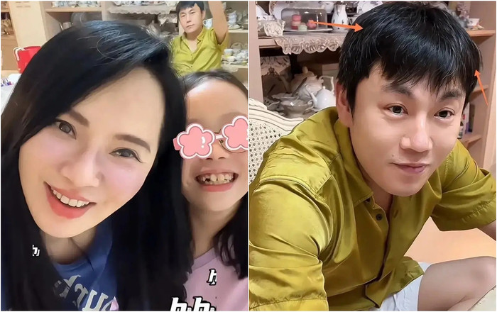 Chồng kém Y Năng Tịnh 10 tuổi bị nhận xét là trông có nhiều dấu hiệu tuổi tác hơn vợ.