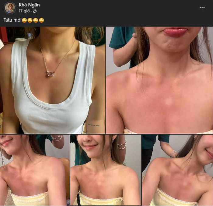 Khả Ngân bị cháy nắng nghiêm trọng