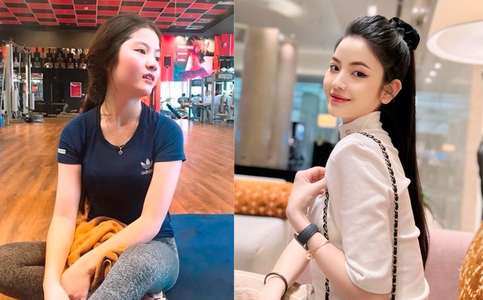 Vợ Quang Hải không phẫu thuật thẩm mỹ. Cô làm đẹp không xâm lấn bằng cách tiêm filler.