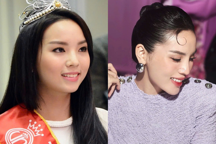 Kỳ Duyên gây sốc khi phủ nhận đã sửa mũi, người đẹp nói đường nét bây giờ là nhờ trưởng thành. 