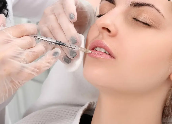 Kết quả của tiêm filler phụ thuộc nhiều yếu tố.
