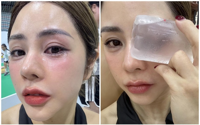 Vợ Huỳnh Anh gặp sự cố Ảnh 2