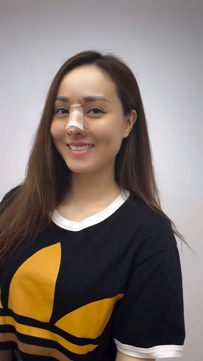 Vợ Công Lý phẫu thuật thẩm mỹ, thay đổi nhan sắc.