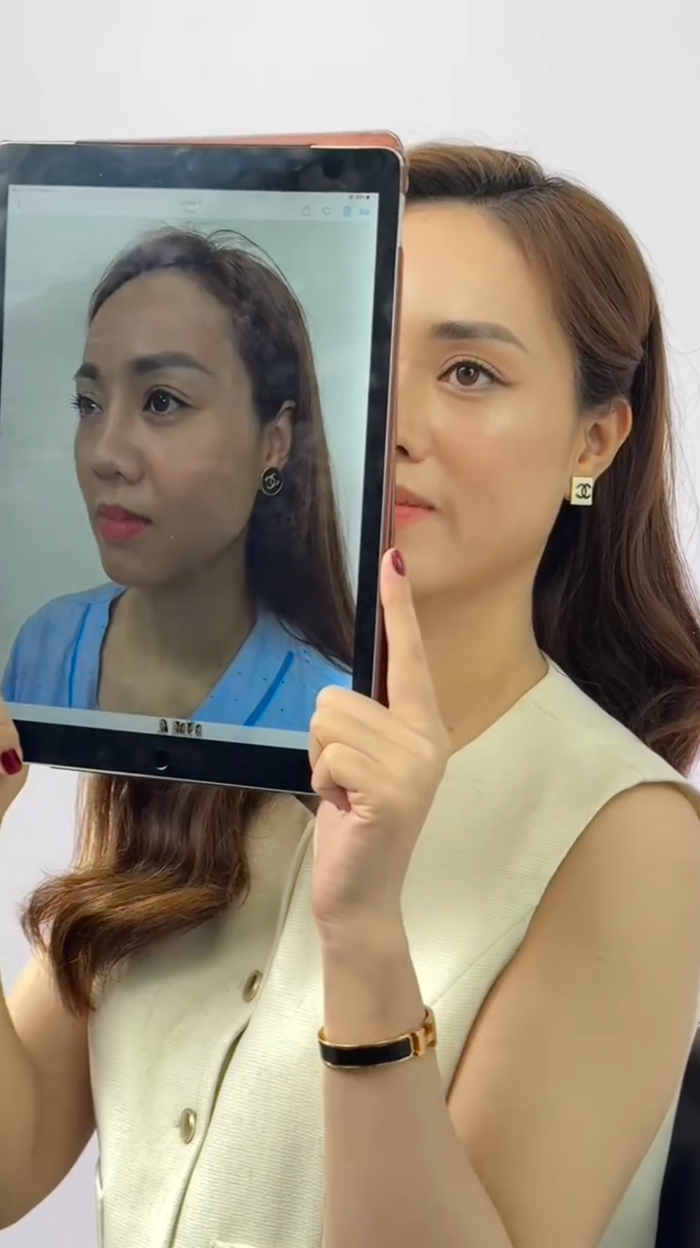 Vợ Công Lý phẫu thuật thẩm mỹ, diện mạo hiện tại gây ngỡ ngàng Ảnh 2