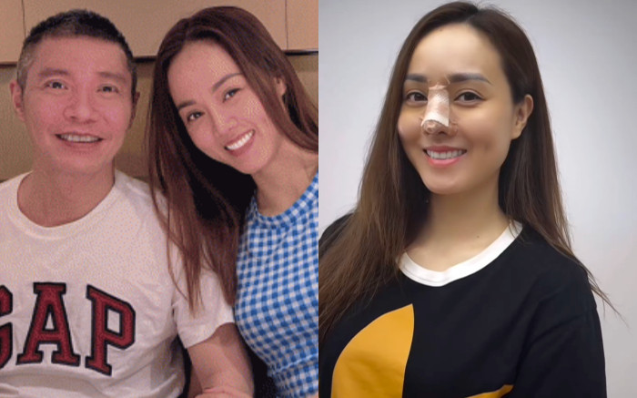 Vợ Công Lý phẫu thuật thẩm mỹ, diện mạo hiện tại gây ngỡ ngàng Ảnh 2