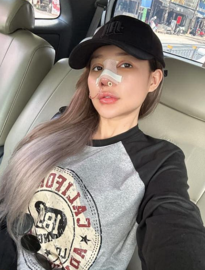 Ngân 98 lo lắng về việc bị biến dạng vì phẫu thuật thẩm mỹ quá nhiều lần. 