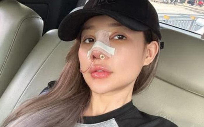 Nỗi sợ của Ngân 98 sau 9 lần sửa mũi Ảnh 2