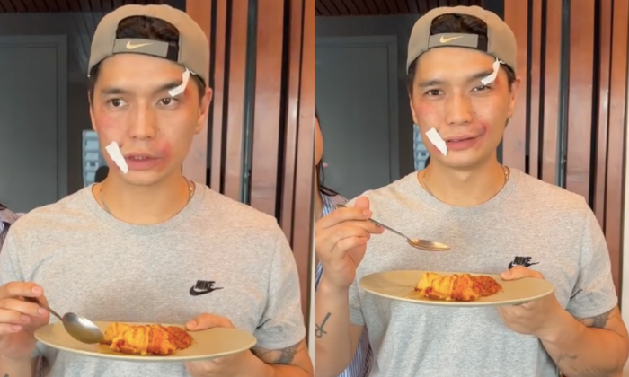 Gương mặt bầm tím, biểu cảm khác lạ của CEO Huy Trần - chồng diễn viên Ngô Thanh Vân. 