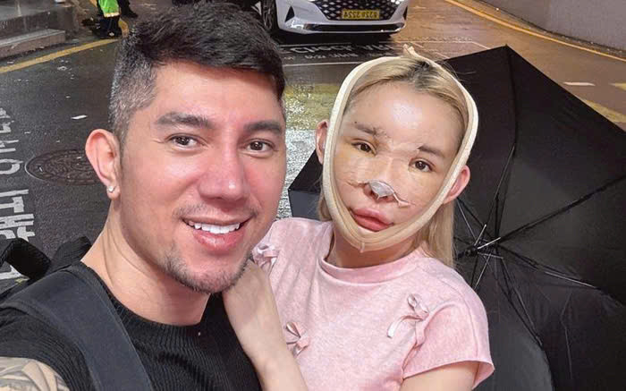 Nữ diễn viên đã có 10 lần thẩm mỹ.