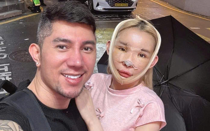 Ngân 98 thẩm mỹ nhiều lần, lý do vì sao? Ảnh 2