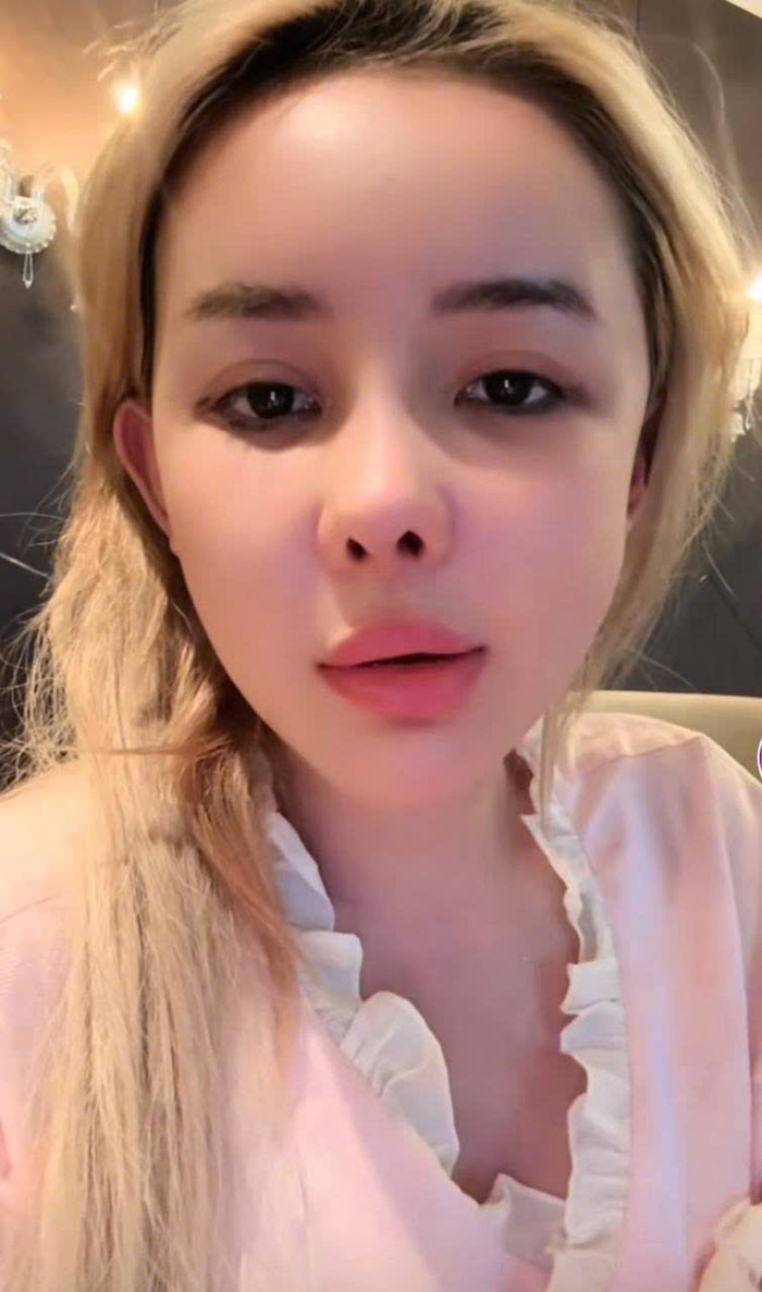 Gương mặt của Ngân 98 thay đổi sau thẩm mỹ.