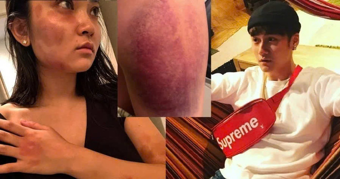 Tưởng Kình Phu bị bạn gái tố bạo hành
