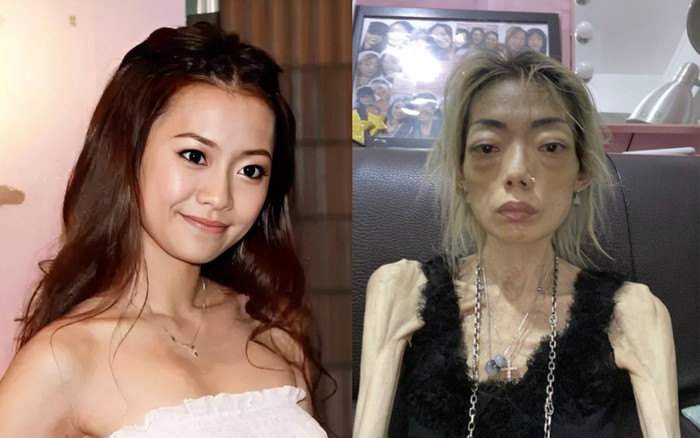 Nữ người mẫu hủy hoại dung nhan, chỉ còn da bọc xương vì lời chê bai của chồng tỷ phú Ảnh 2