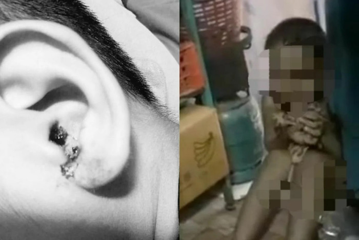 Cô giáo tát bé trai 6 tuổi chảy máu tai vì không trả lời được câu hỏi (Theo The Thaiger)