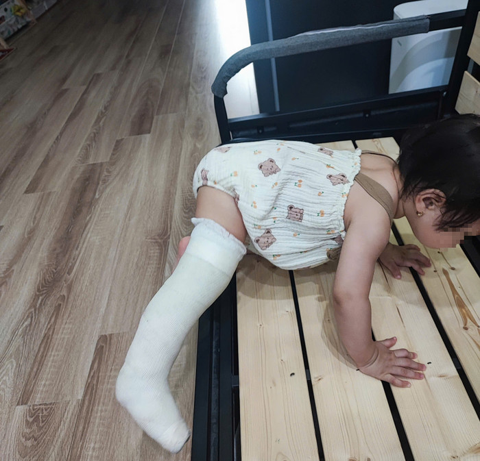 Bé gái 13 tháng tuổi bị gãy chân sau khi đi học về.