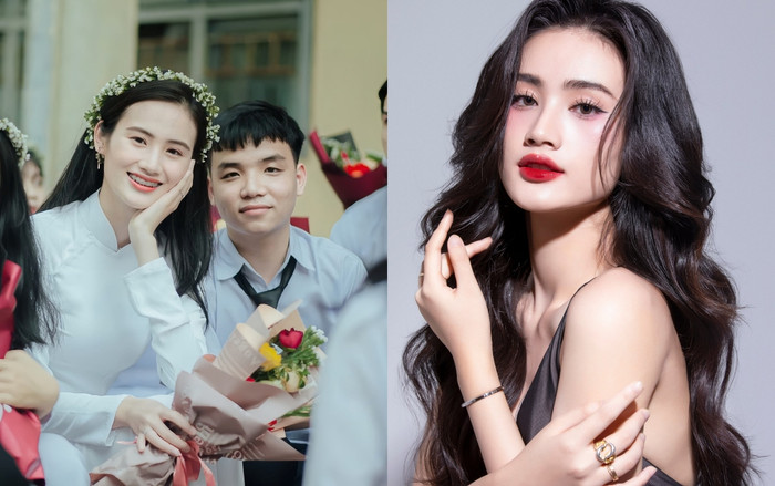 Hoa hậu Ý Nhi trước và sau khi niềng răng.