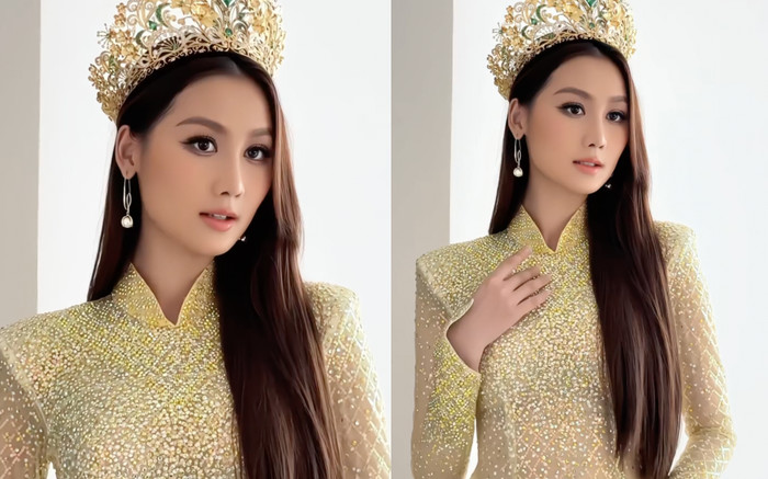 Hoa hậu Quế Anh đã can thiệp 'dao kéo'? Ảnh 2