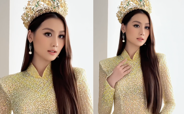 Hoa hậu Quế Anh lộ phần mũi nhọn, chiếc cằm thon gọn lạ thường.