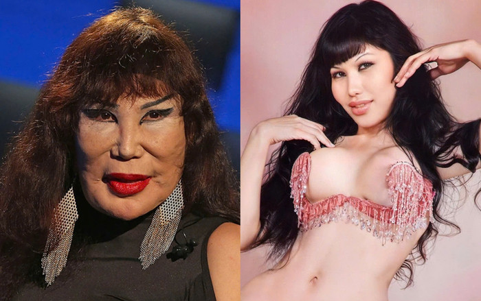 Bi kịch thẩm mỹ của nữ diễn viên 71 tuổi Ảnh 2