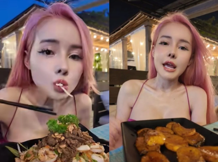 Tháng 11/2024, Ngân 98 sẽ tiếp tục 'dao kéo' vì phần sụn mũi bị co rút.