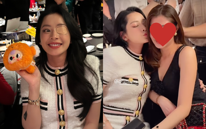 Chi Pu cười tươi rói, vui vẻ chơi đùa cùng bạn bè dù bản thân đang đeo băng gạc che mắt. Ảnh: Instagram chipupu