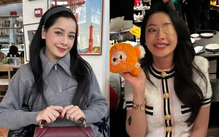 Chi Pu đeo băng gạc che mắt, netizen lo lắng cho sức khoẻ của nữ ca sĩ Ảnh 2
