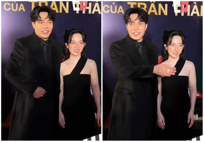 Em vợ Lê Dương Bảo Lâm xuất hiện với gương mặt bị lệch hẳn sang một bên. (Ảnh Cayphimnayne)