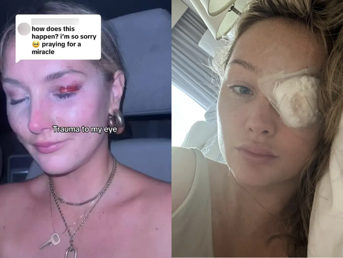 Nữ người mẫu đã trải qua chín cuộc phẫu thuật mắt nhưng kỳ tích không hề xuất hiện.