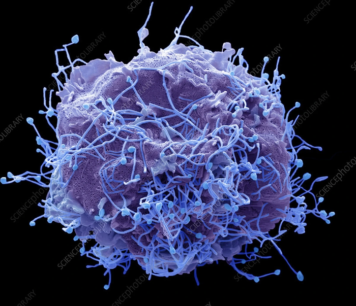 Hình ảnh virus HMPV dưới kính hiển vi. Ảnh: Science Photo.