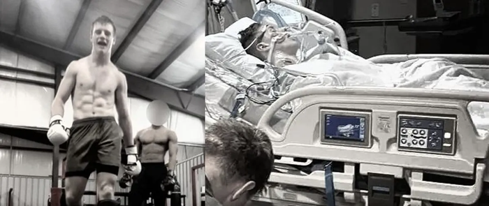 Vận động viên MMA (18 tuổi) mất ý thức sau buổi tập luyện, nguyên nhân bị nghi ngờ là do nước tăng lực gây nên. 