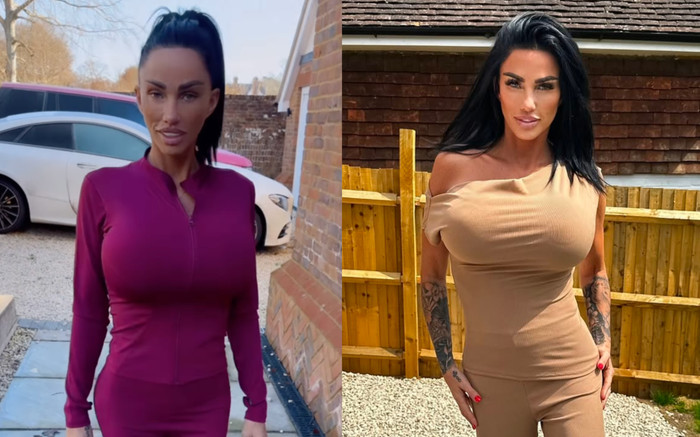 Phát hoảng trước diện mạo biến dạng của nữ người mẫu nghiện 'dao kéo' Ảnh 2