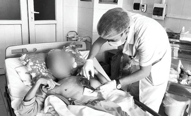 Bác sĩ kiểm tra ca bệnh mắc nấm hiếm gặp bị hoại tử vùng ngực. Ảnh: Báo Lao Động.