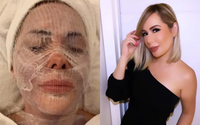 Nữ người mẫu chi 1,5 tỷ mỗi tháng cho các liệu pháp làm đẹp 'độc lạ' Ảnh 2