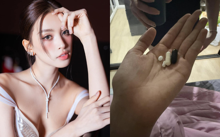 Hoa hậu Tiểu Vy bị sốt co giật Ảnh 2