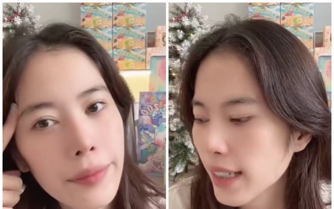 Nam Em tiết lộ nguyên nhân khiến gương mặt bị biến dạng Ảnh 2