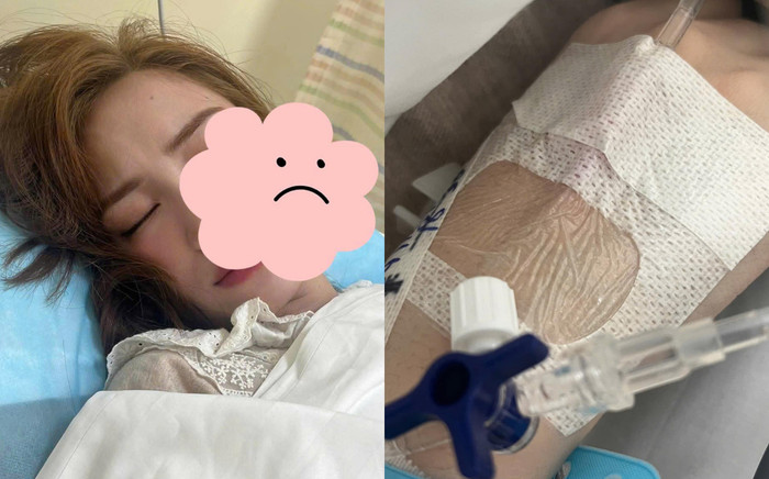 Hình ảnh Hòa Minzy tiều tuỵ trên giường bệnh khiến nhiều người xót xa. (Ảnh: FB Châu Nhật Nguyên)