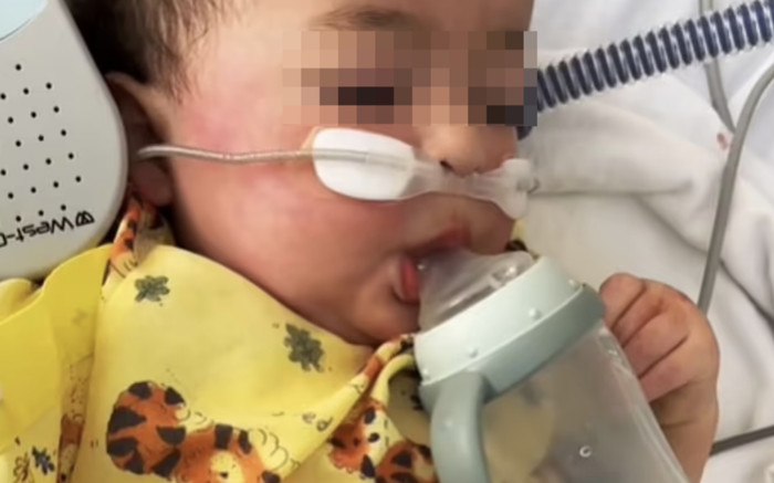 Bệnh nhân nhiễm virus HMPV: 'Triệu chứng kinh hoàng, tệ nhất tôi từng trải qua' Ảnh 2