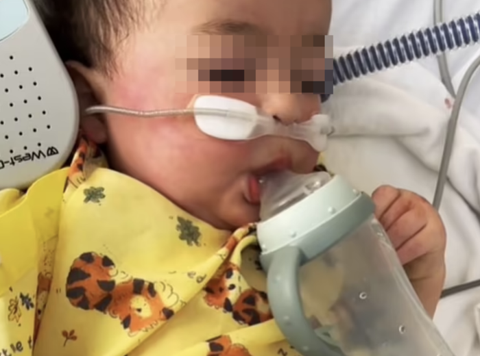 Một trường hợp nhỏ tuổi khác cũng bị nhiễm virus HMPV.