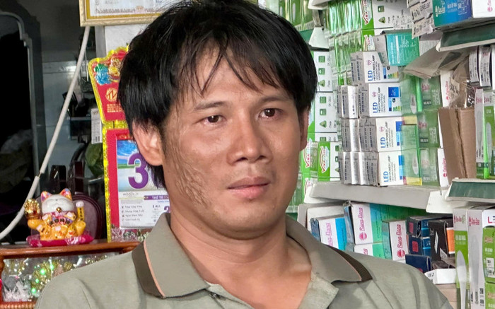 Gương mặt biến dạng vì tai nạn của Thanh Thức Ảnh 2