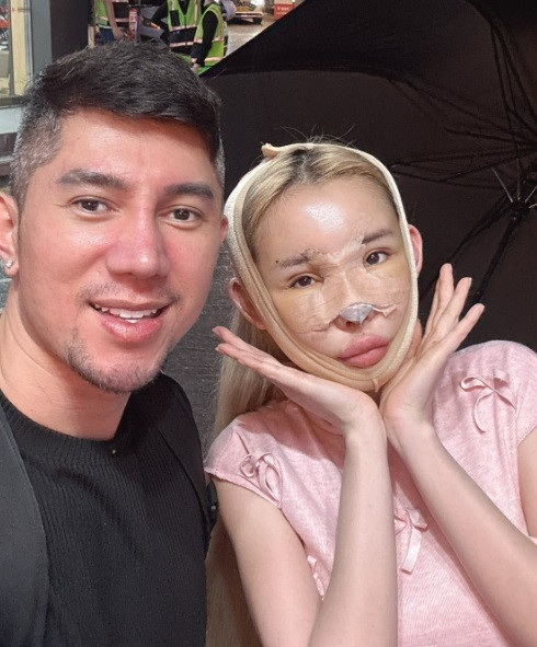 Lương Bằng Quang chăm sóc Ngân 98 trong thời gian bạn gái phẫu thuật thẩm mỹ. (Ảnh FBNV)