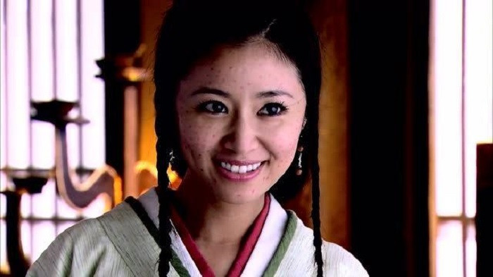 Những chấm đen này của Lâm Tâm Như cũng gọi là xấu?