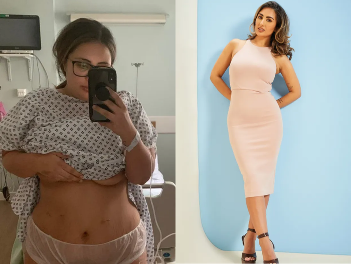 Một cô gái đã phải nhập viện sau khi thực hiện phương pháp phẫu thuật giảm cân.