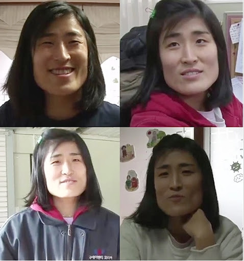 Cô gái xấu xí lột xác thành mỹ nhân sau khi phẫu thuật thẩm mỹ, cưới luôn bác sĩ bệnh viện Ảnh 2