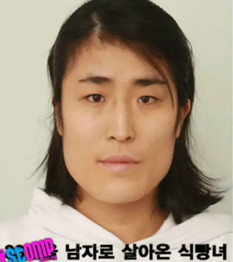 Cô gái xấu xí lột xác thành mỹ nhân sau khi phẫu thuật thẩm mỹ, cưới luôn bác sĩ bệnh viện Ảnh 1