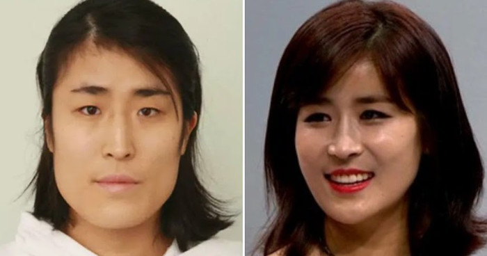 Cô gái xấu xí lột xác thành mỹ nhân sau khi phẫu thuật thẩm mỹ, cưới luôn bác sĩ bệnh viện Ảnh 4