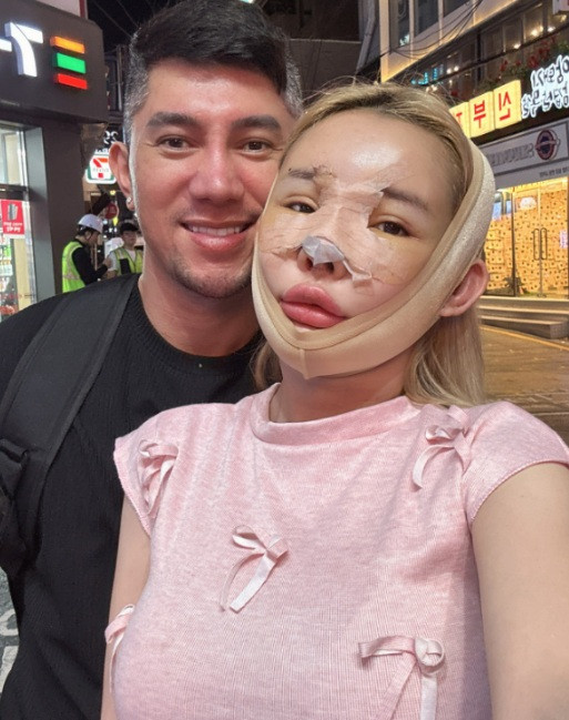 Ngân 98 từng qua Hàn phẫu thuật thẩm mỹ và công khai quá trình này lên mạng xã hội. (Ảnh FBNV)