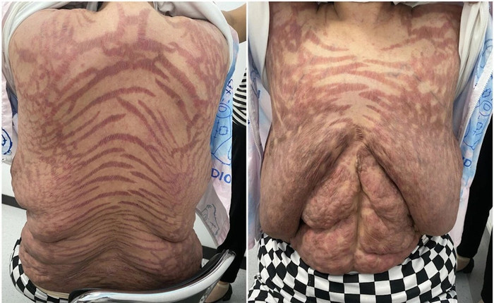 Bôi thuốc trị ngứa mua trên mạng, cơ thể người phụ nữ biến dạng kinh hoàng Ảnh 3