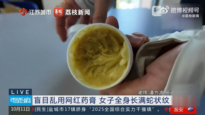 Bôi thuốc trị ngứa mua trên mạng, cơ thể người phụ nữ biến dạng kinh hoàng Ảnh 1